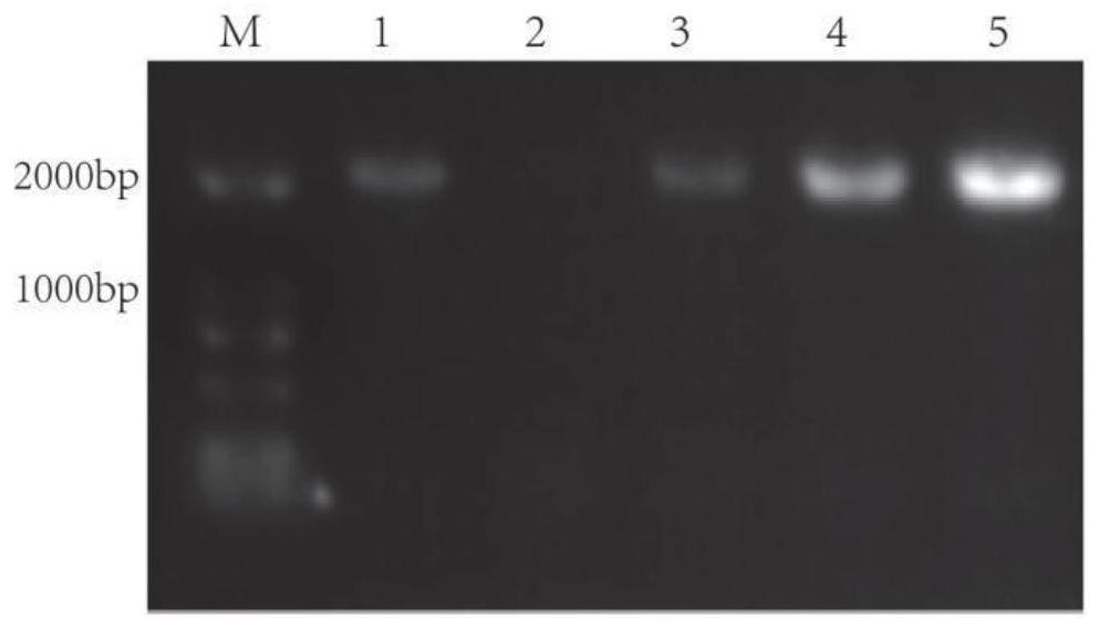 Candida utilis double-gene co-expression strain for hydrolyzing protein components in kitchen waste and construction method of candida utilis double-gene co-expression strain