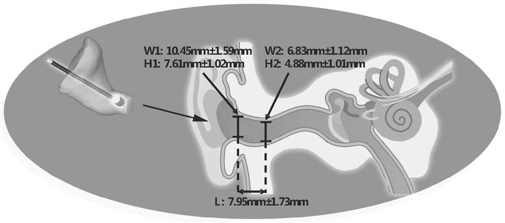 Wearable single-conduction universal in-ear electroencephalogram sensor