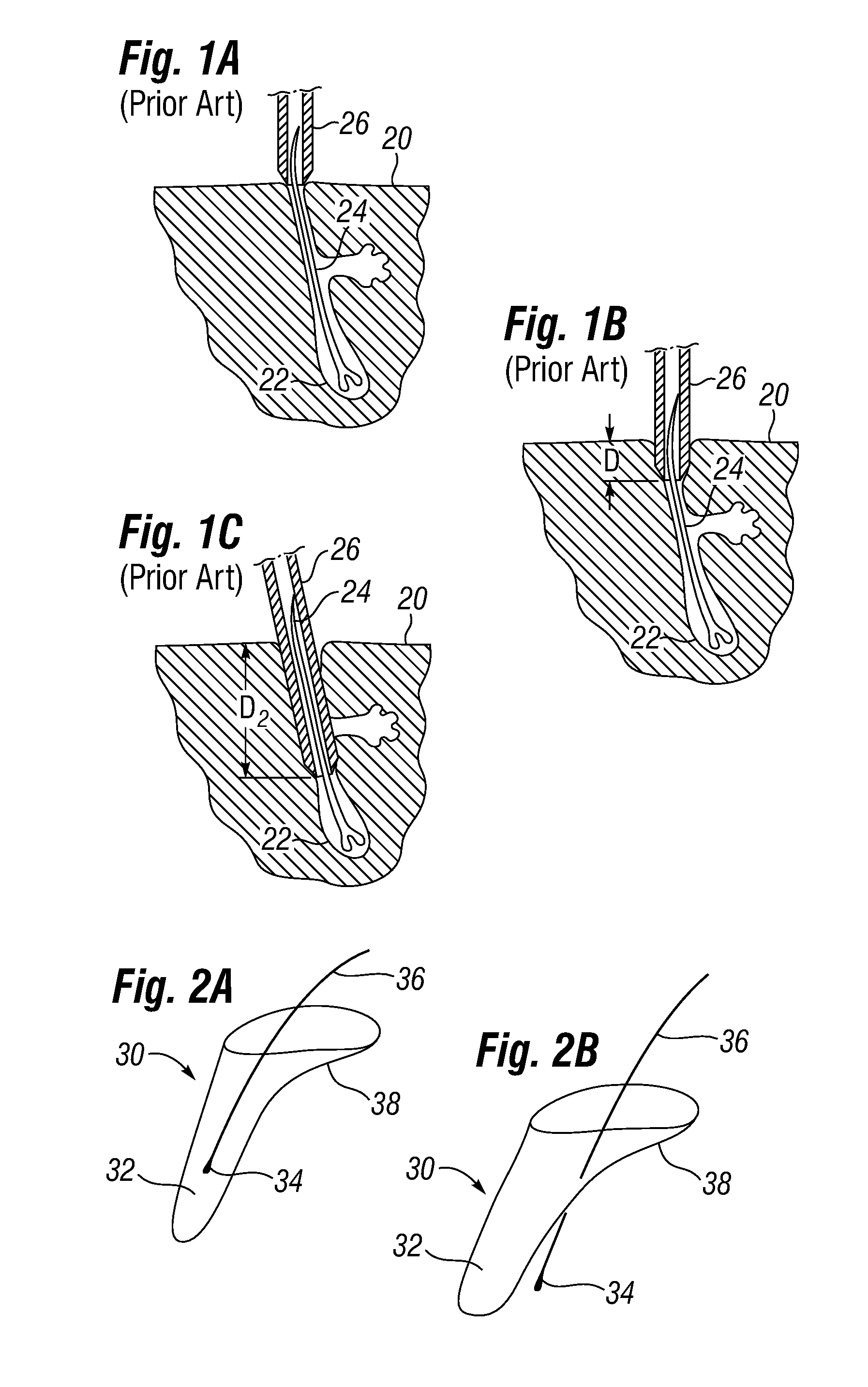 Biological unit removal tools with concentric tubes