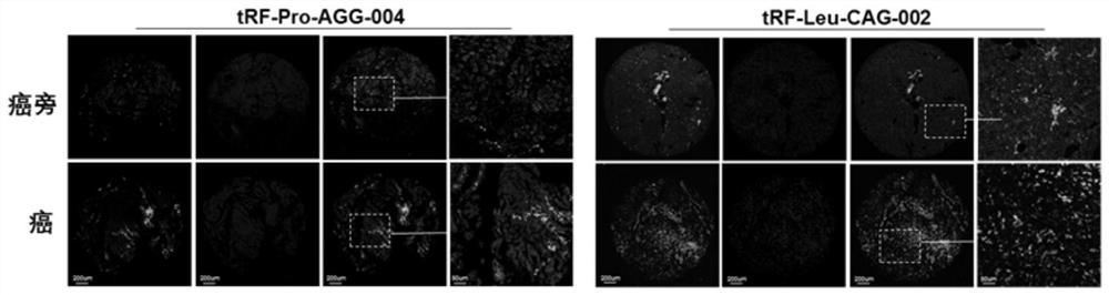 tsRNA marker for detecting cancer tissue and para-carcinoma tissue of pancreatic cancer, probe and application thereof