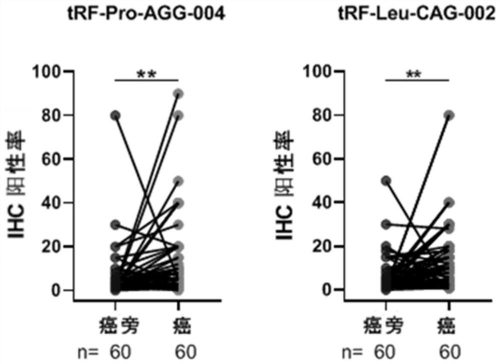 tsRNA marker for detecting cancer tissue and para-carcinoma tissue of pancreatic cancer, probe and application thereof