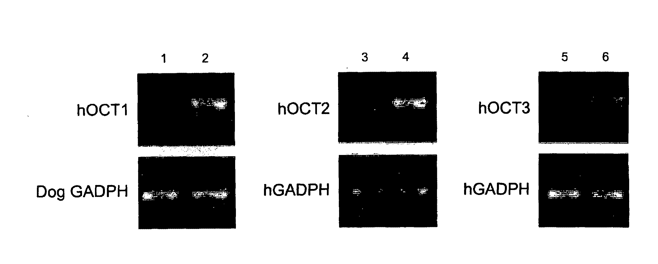 Use of organic cation transporters for cancer diagnosis and therapy