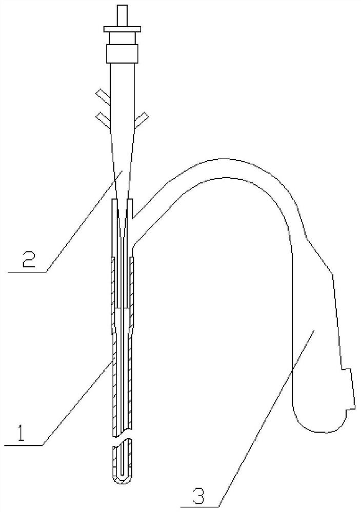 Visual intramedullary fixation system