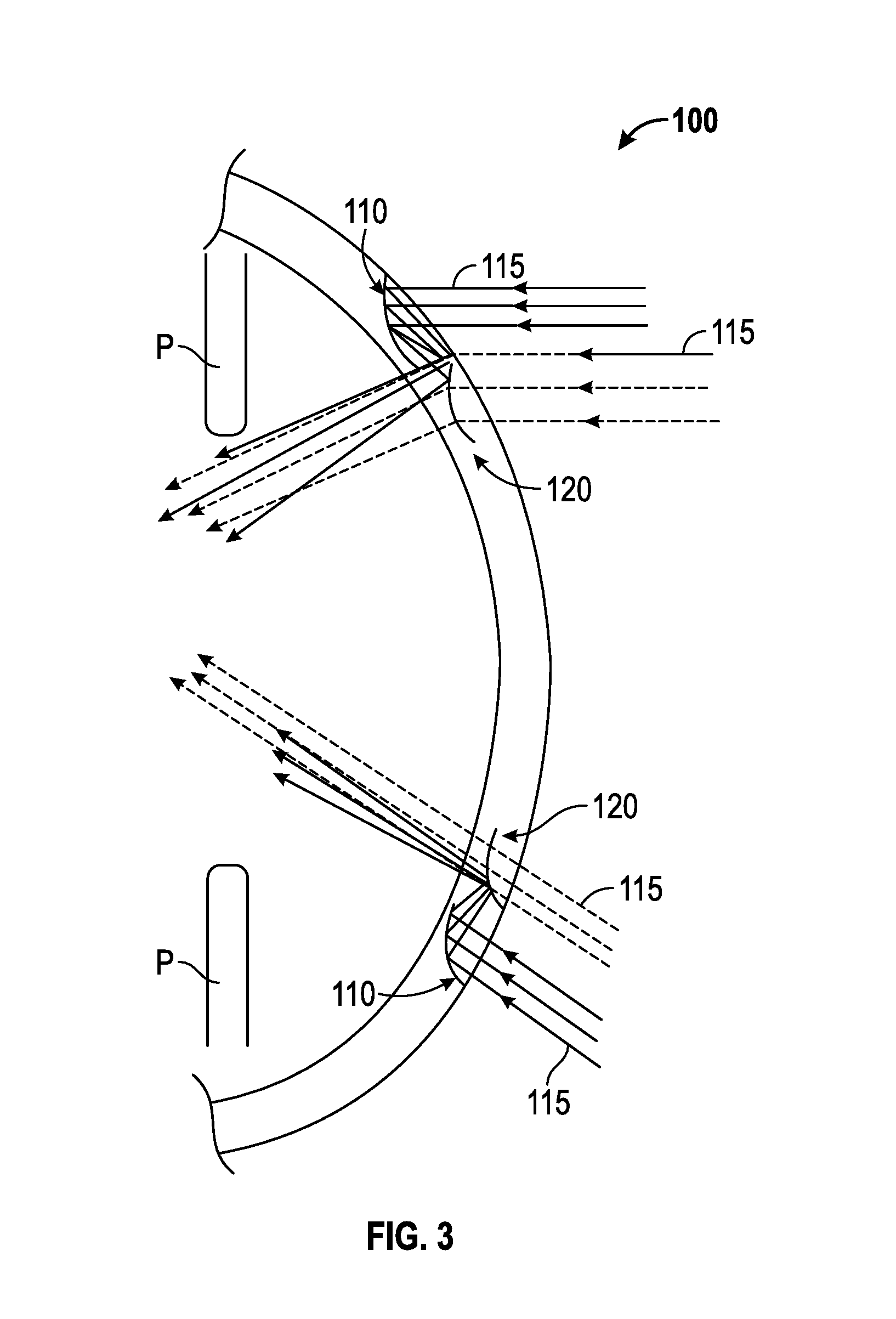 Eye-wear borne electromagnetic radiation refractive therapy