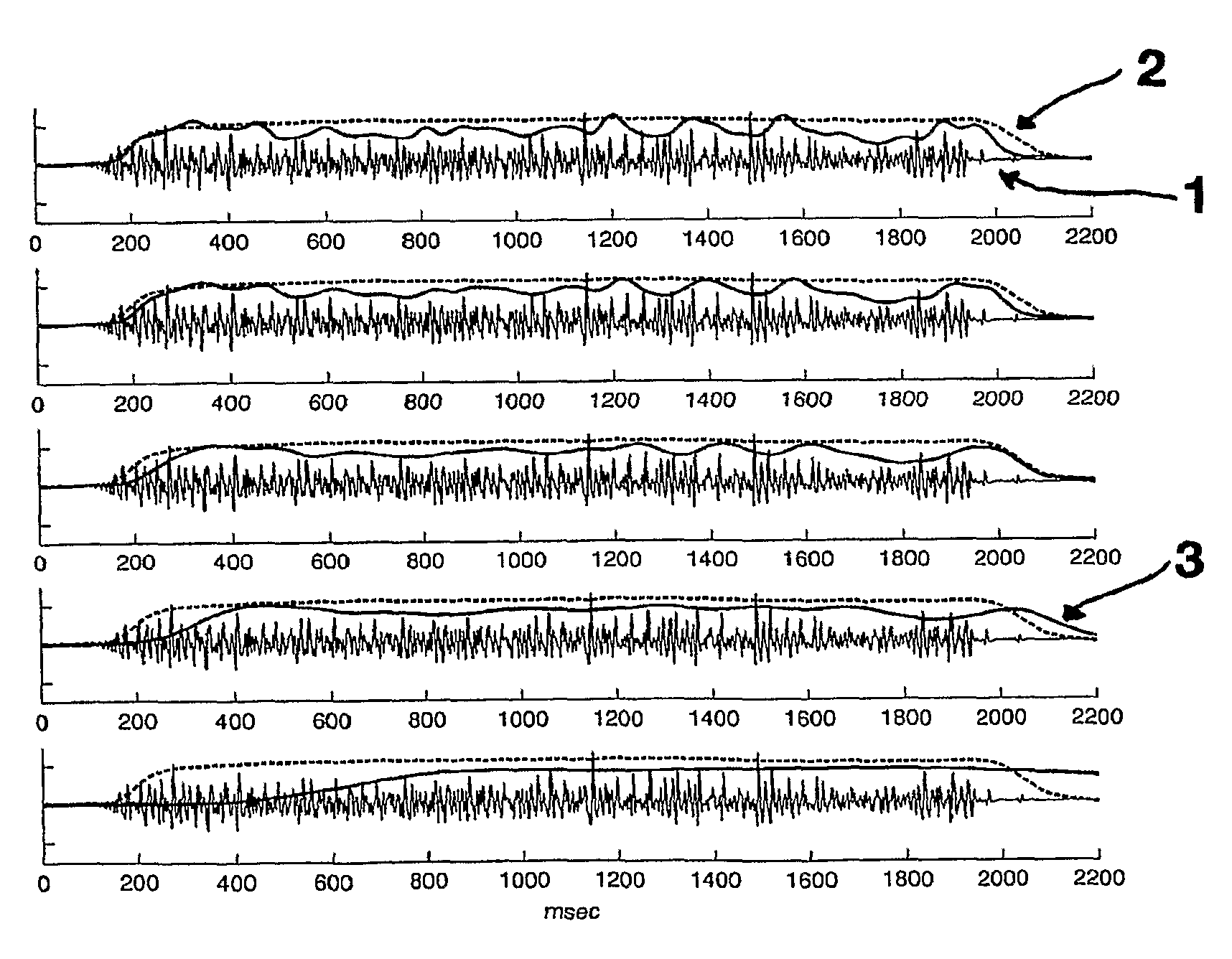 Systems and methods for estimating surface electromyography