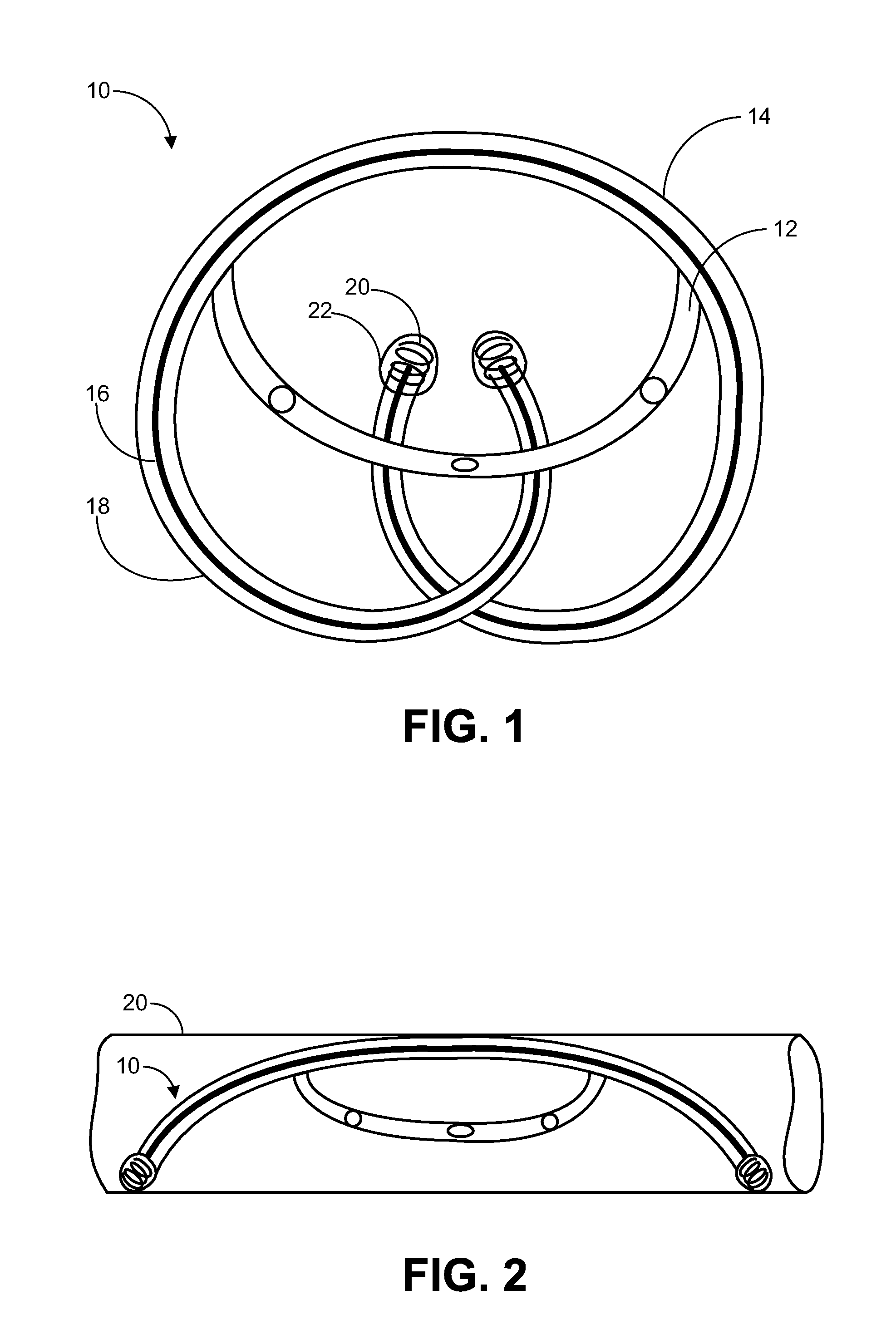 Implantable drug delivery device and methods for treatment of the bladder and other body vesicles or lumens