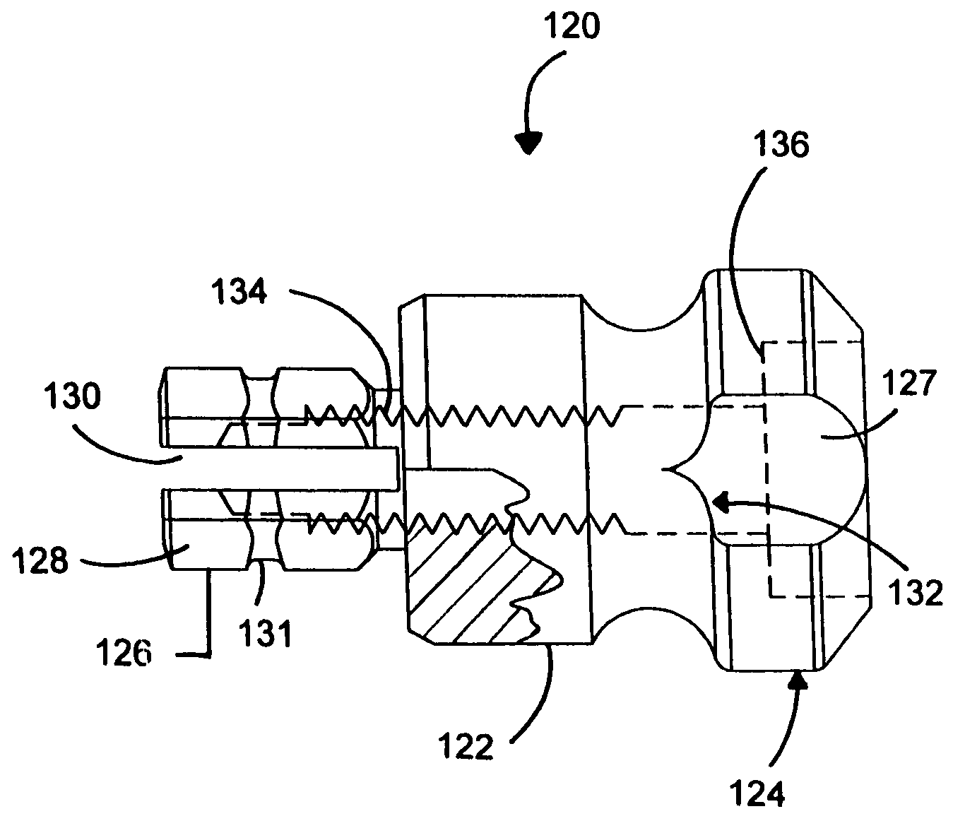 Implant delivery system