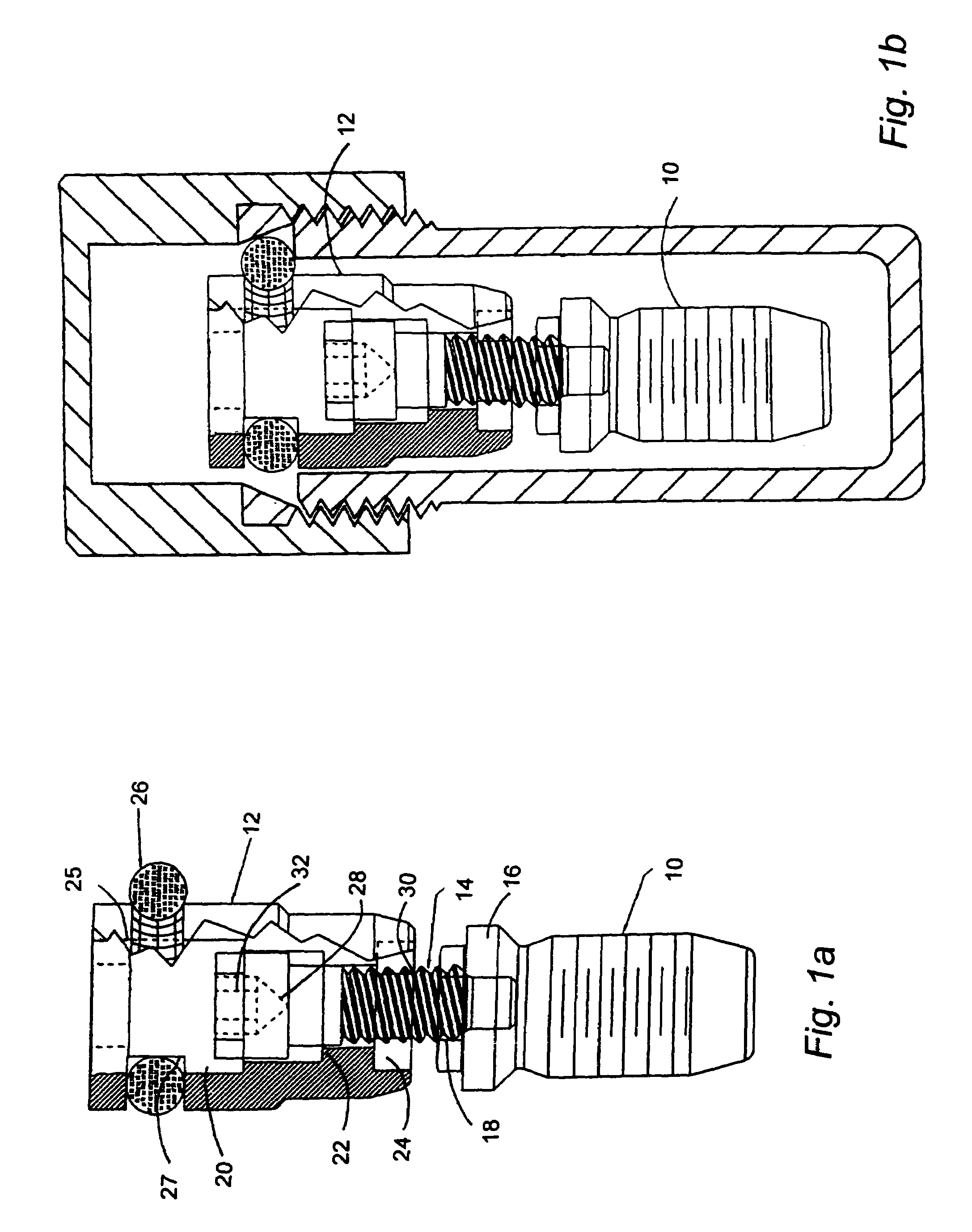 Implant delivery system