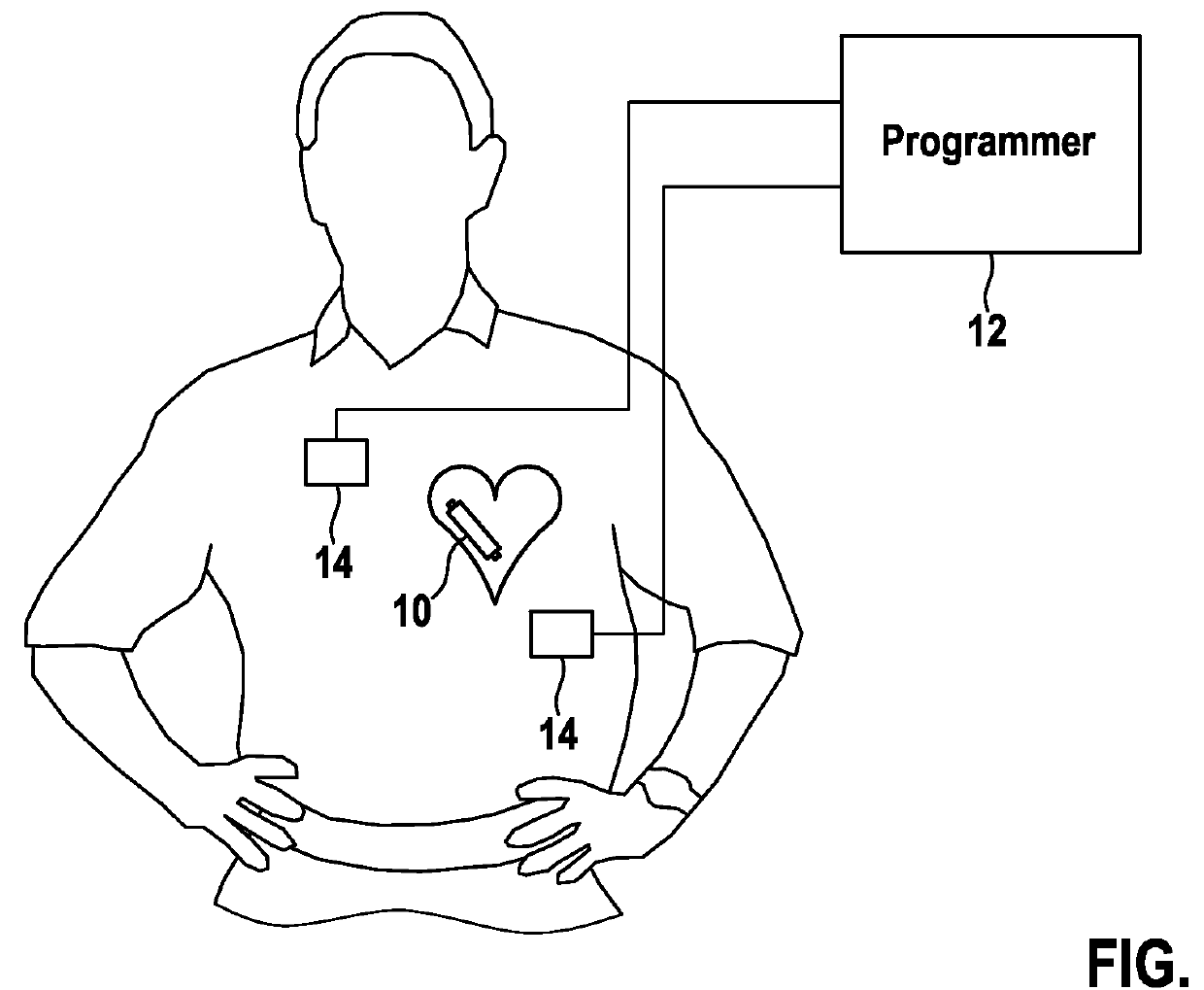 Implantable medical device, medical system and method for data communication