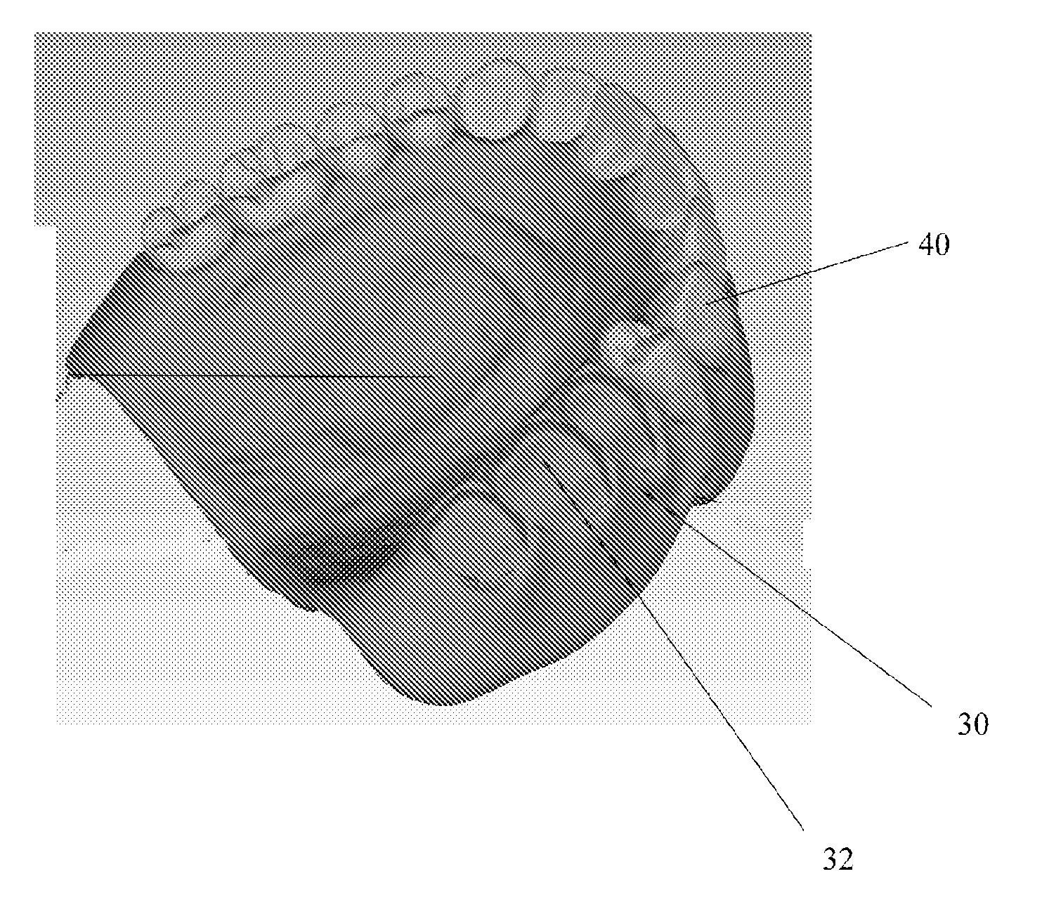 System and process for optimization of dentures