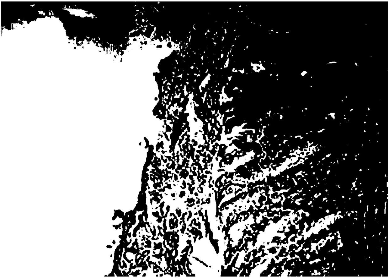 Application of succinic acid and lipoic acid to preparation of anti-stress visceral injury medicine