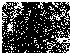 Histological classification immunohistochemical multiple staining detection method for lung cancer