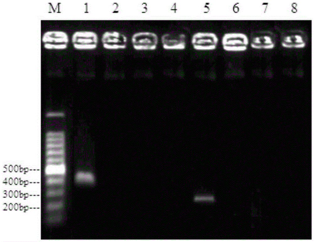 Primers and method for detection of enterobacter cloacae O20 type