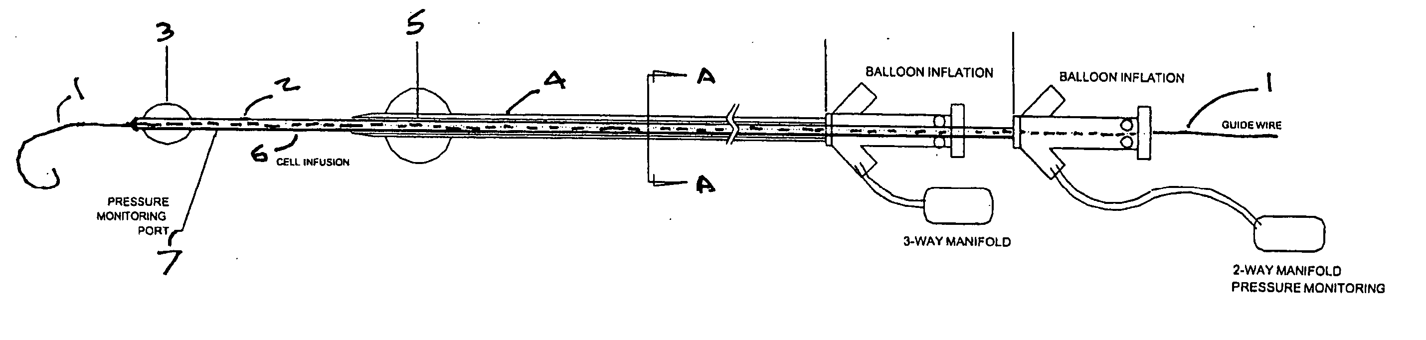 Method and apparatus for localized drug delivery