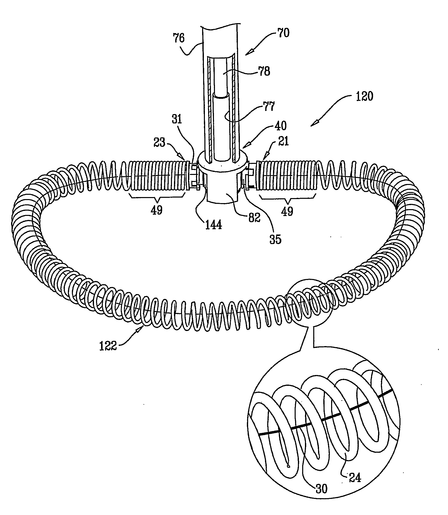 Adjustable annuloplasty devices and adjustment mechanisms therefor