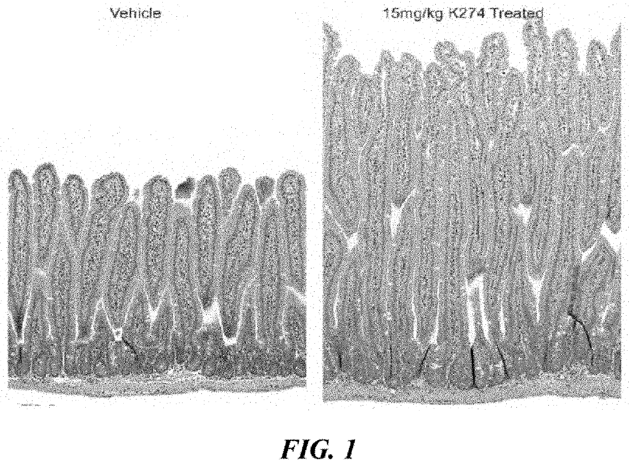 Glp-2 analogs and peptibodies for administration before, during or after surgery