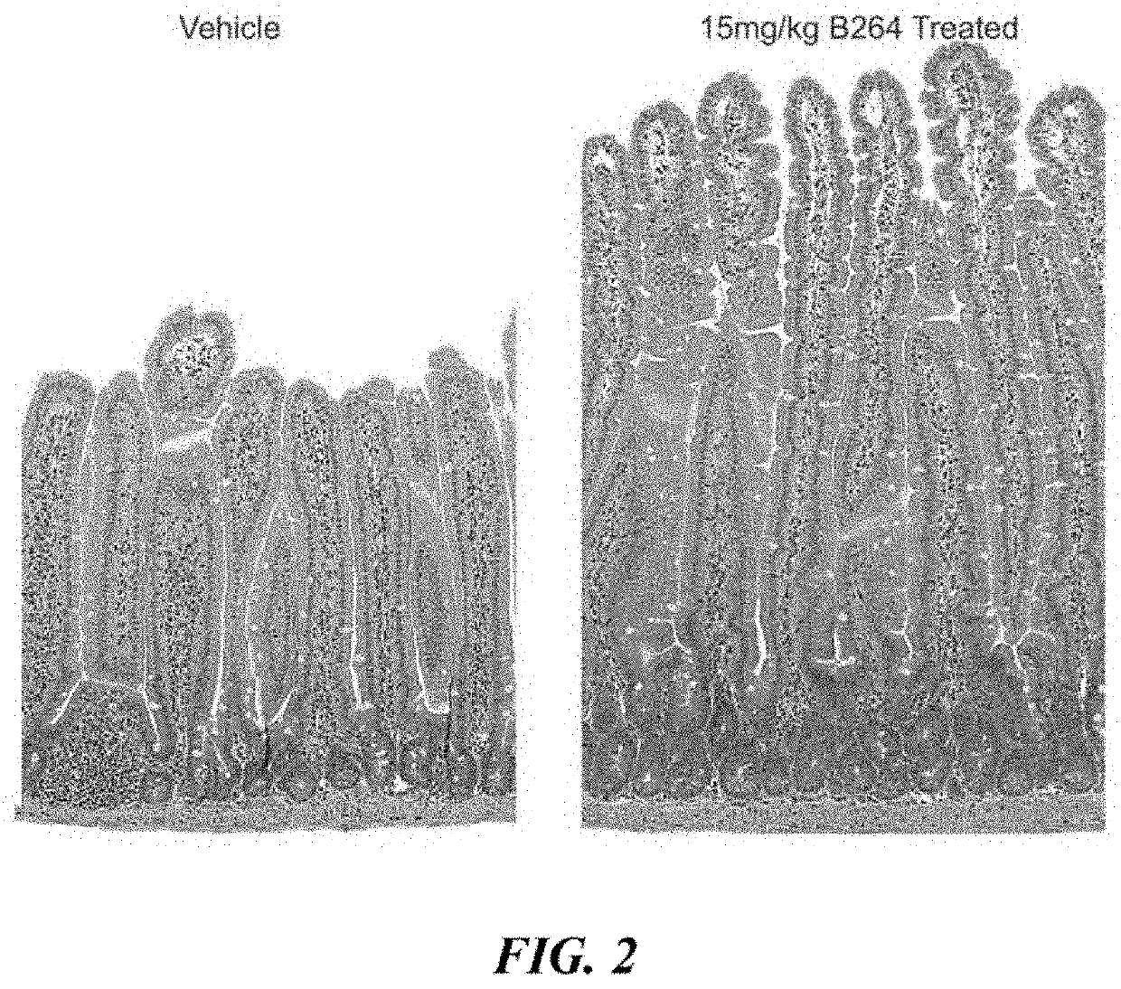 Glp-2 analogs and peptibodies for administration before, during or after surgery