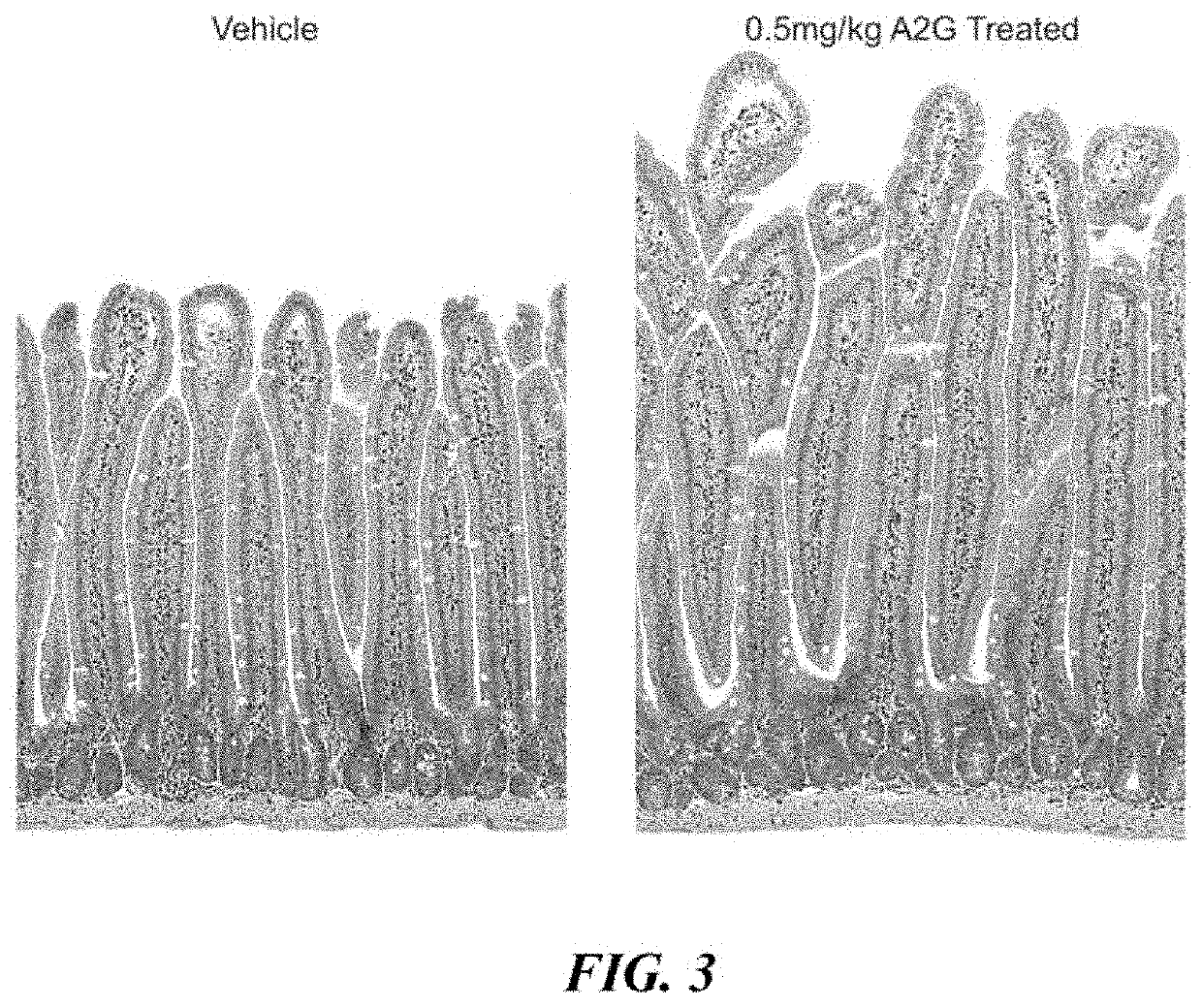 Glp-2 analogs and peptibodies for administration before, during or after surgery