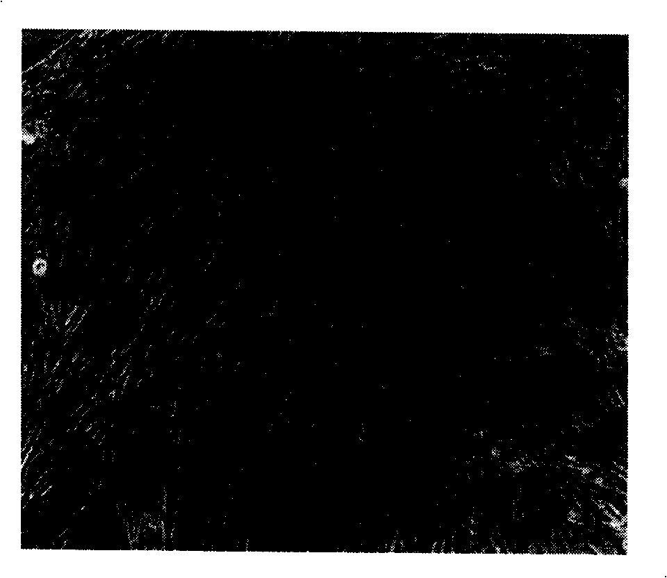 Method for cultivating adult distal arteria pulmonalis smooth muscle cells