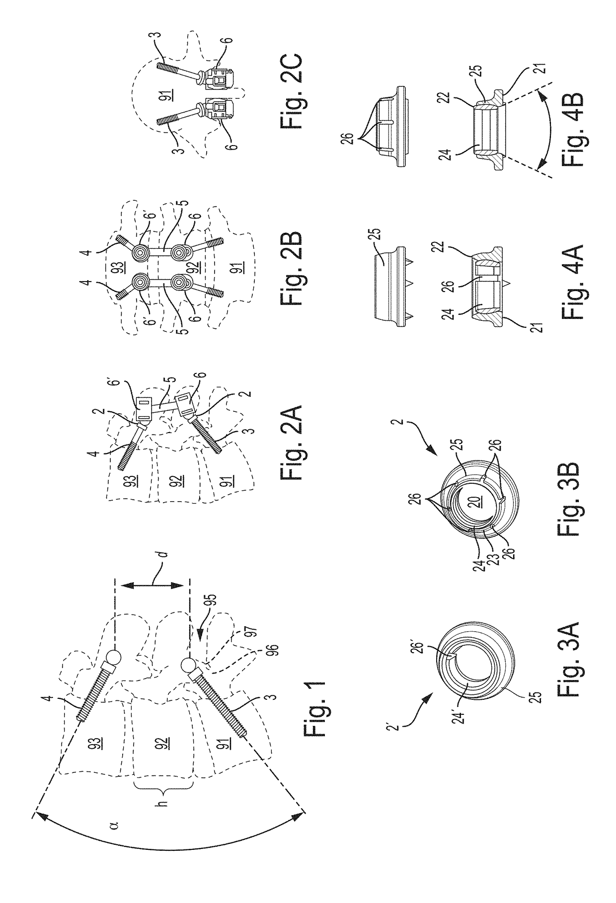 Spinal multi-level intersegmental stabilization system and method for implanting