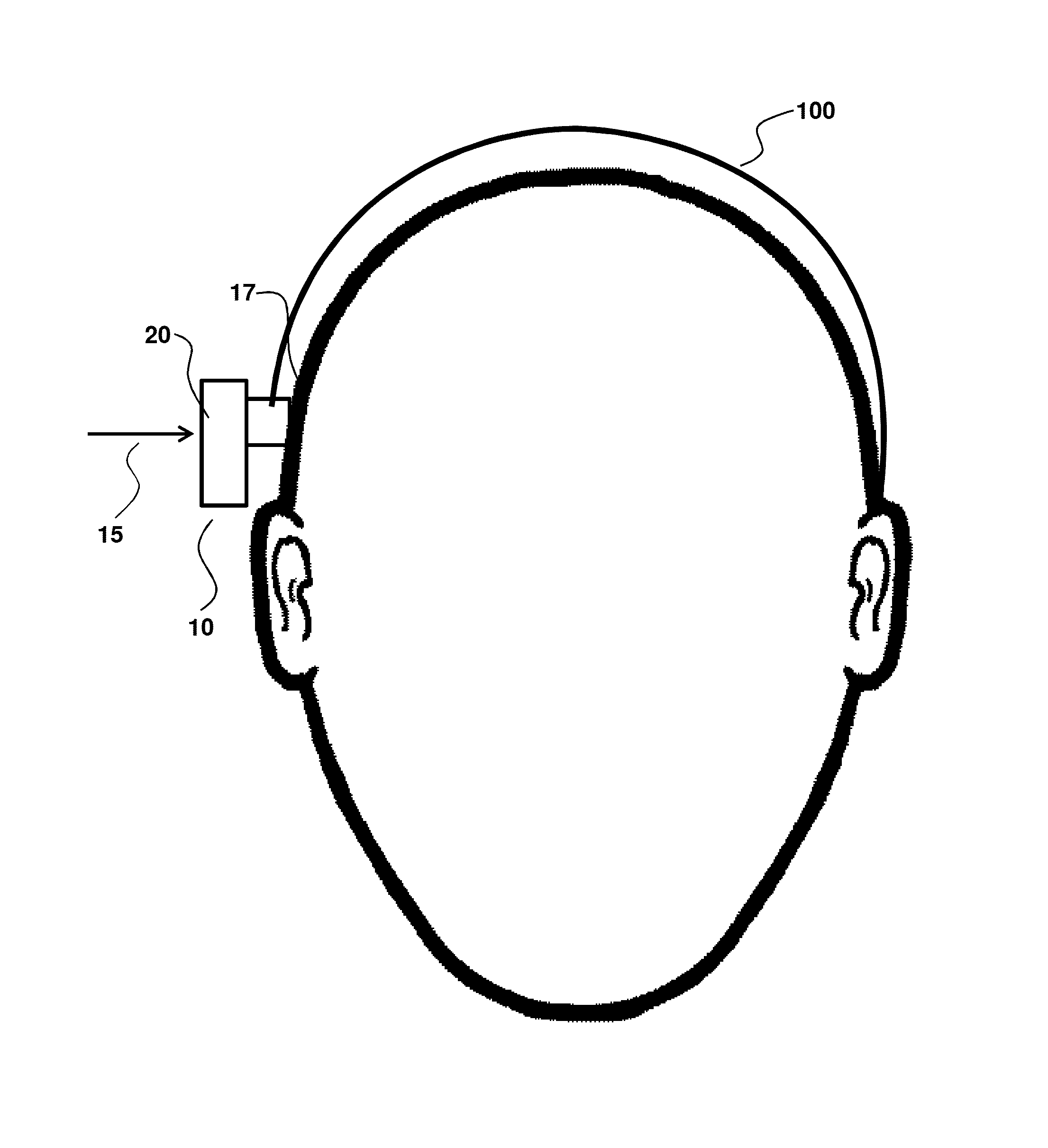 Adhesive bone conduction hearing device