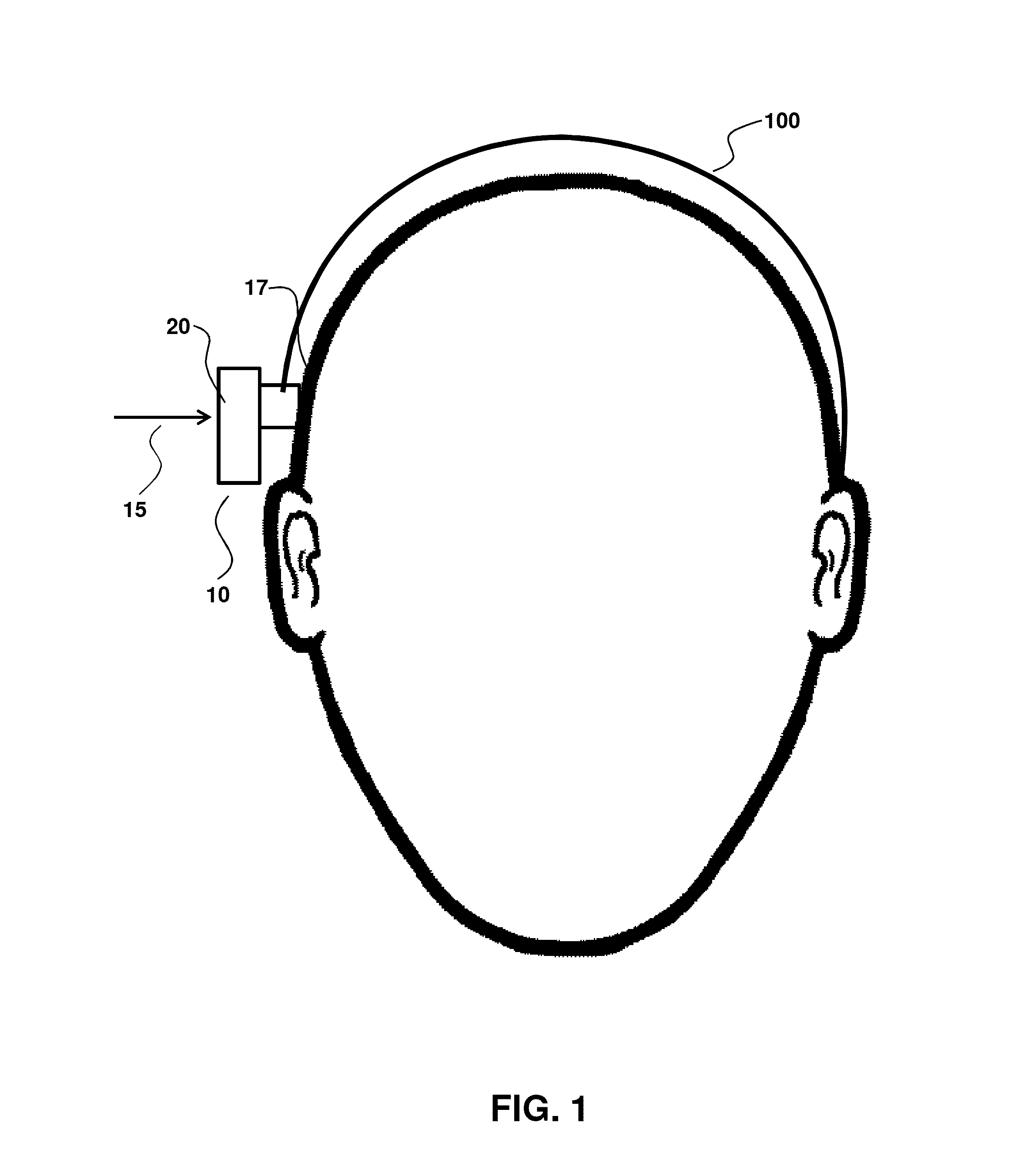 Adhesive bone conduction hearing device