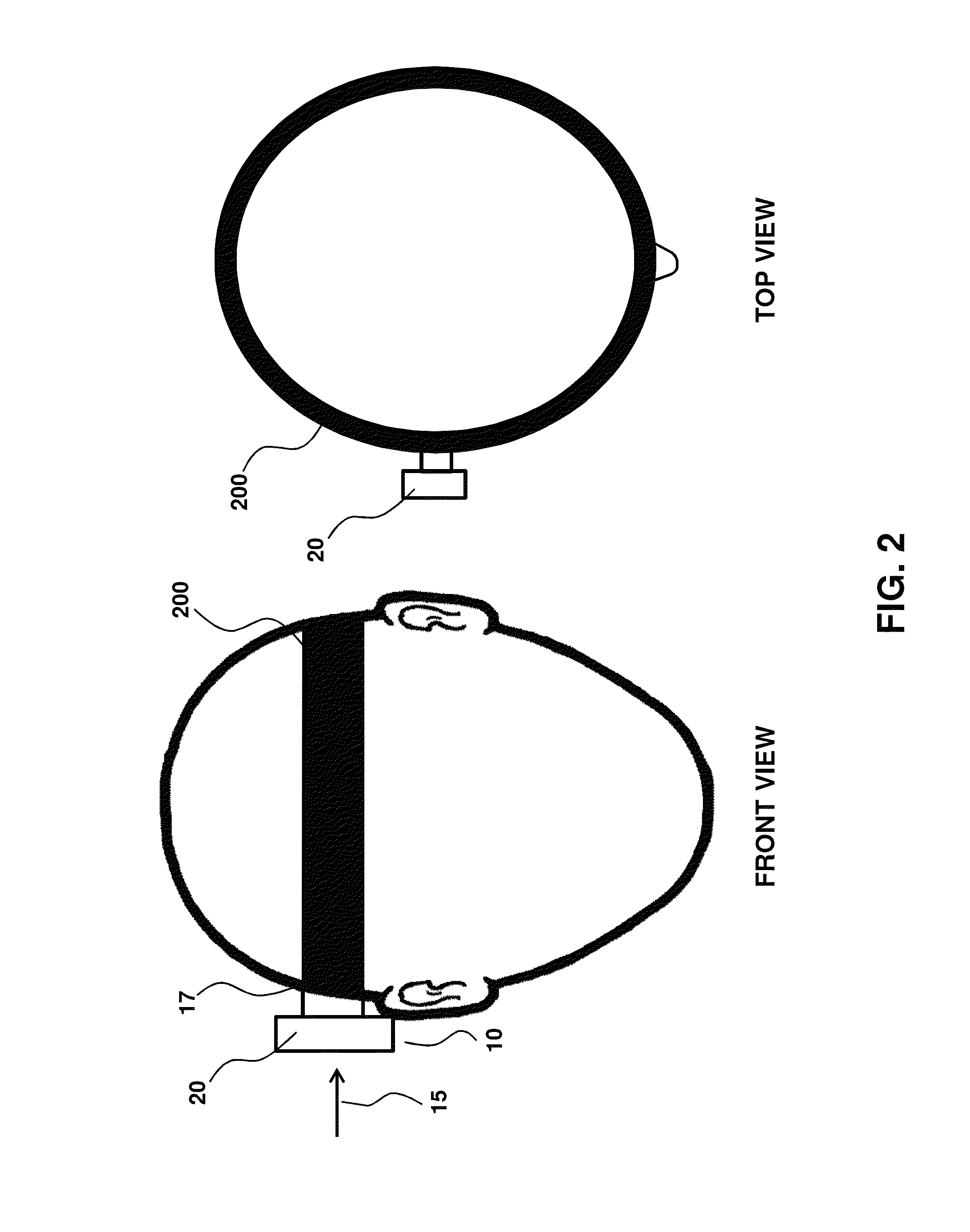 Adhesive bone conduction hearing device