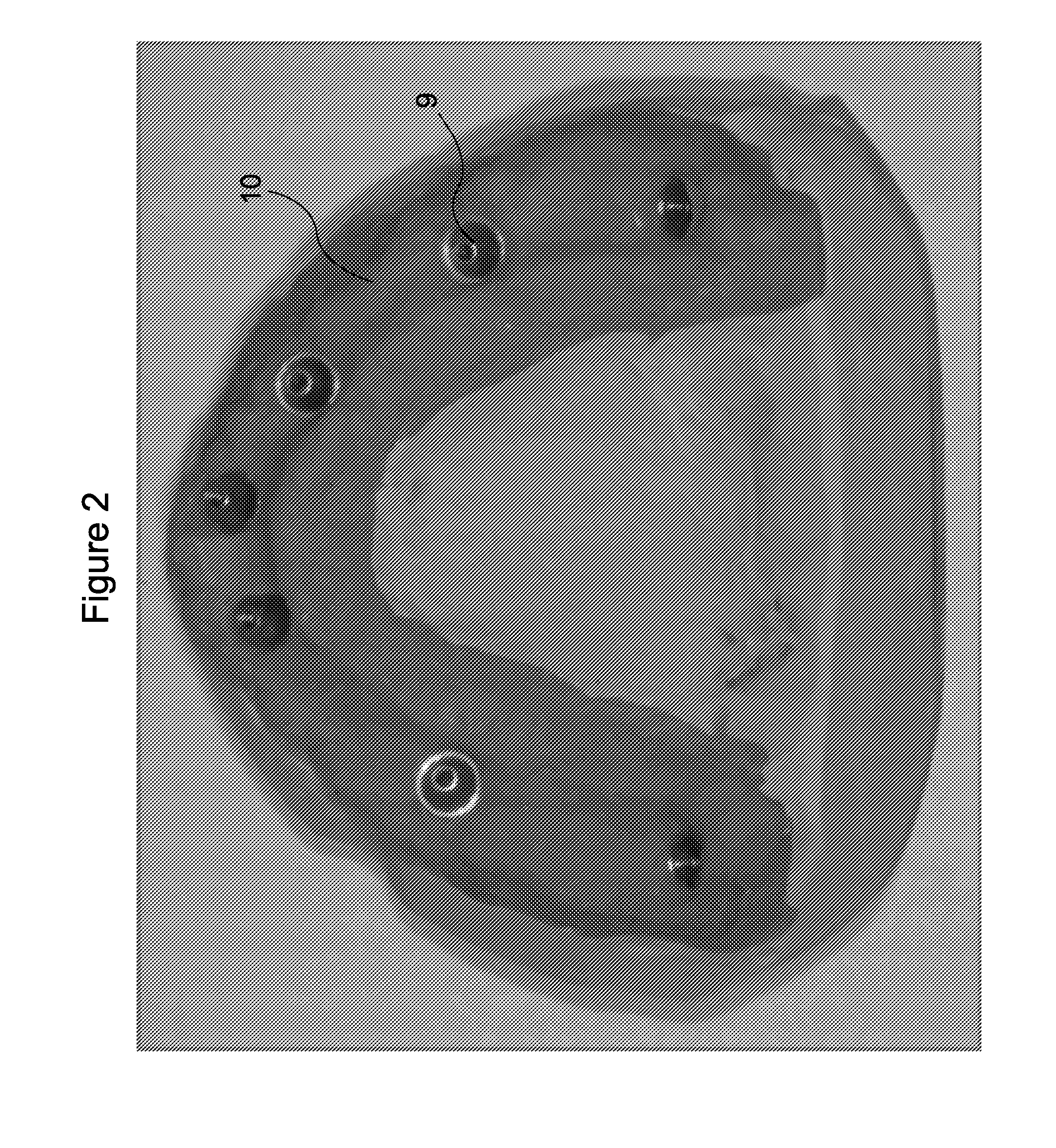 Dental prosthesis and method of its production utilizing standardized framework keys and matching premanufactured teeth