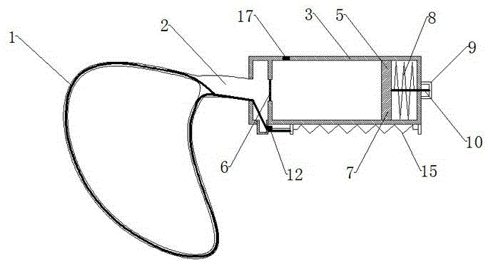 Laparoscope specimen bag capable of automatically opening and closing