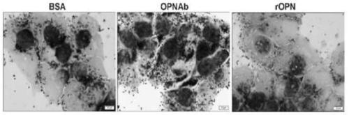 Application of osteopontin as target molecule in regulation of intestinal flora colonization