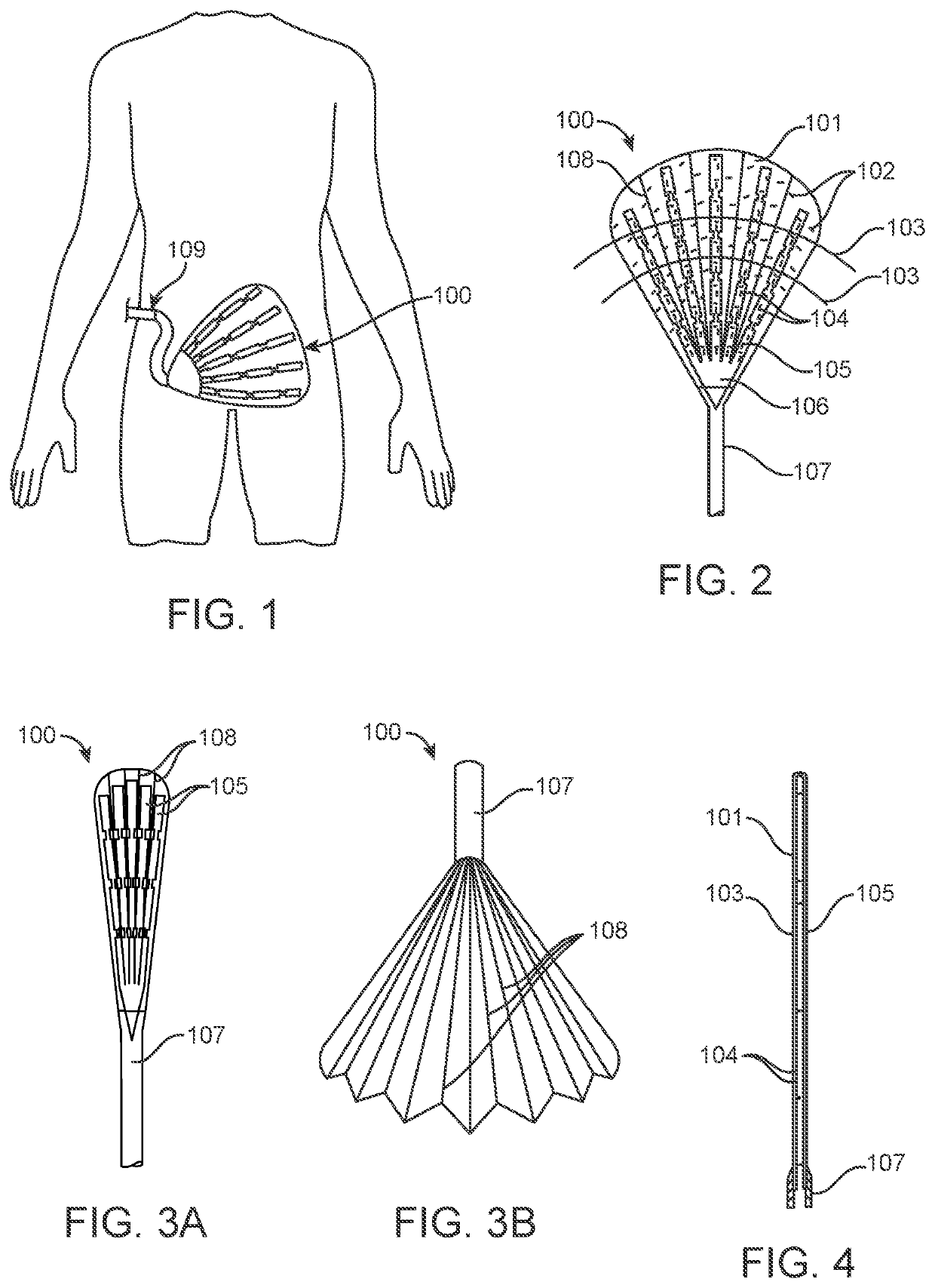 Apparatuses and methods for improving recovery from minimally invasive surgery