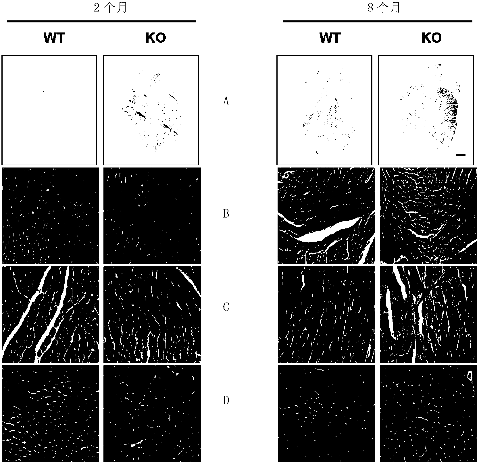 New application of casein kinase2-interacting protein-1 (CKIP-1) protein and coding gene thereof