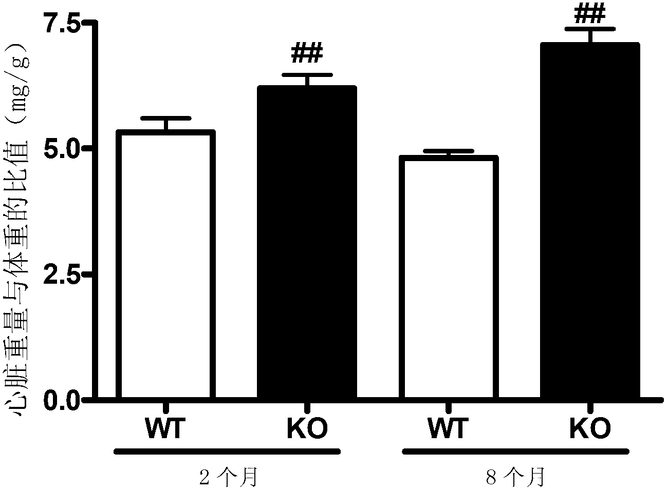 New application of casein kinase2-interacting protein-1 (CKIP-1) protein and coding gene thereof