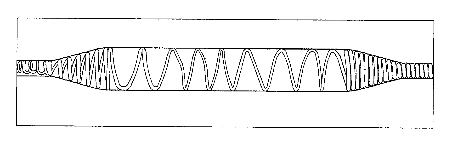 Rupture-resistant compliant radiopaque catheter balloon and methods for use of same in an intravascular surgical procedure