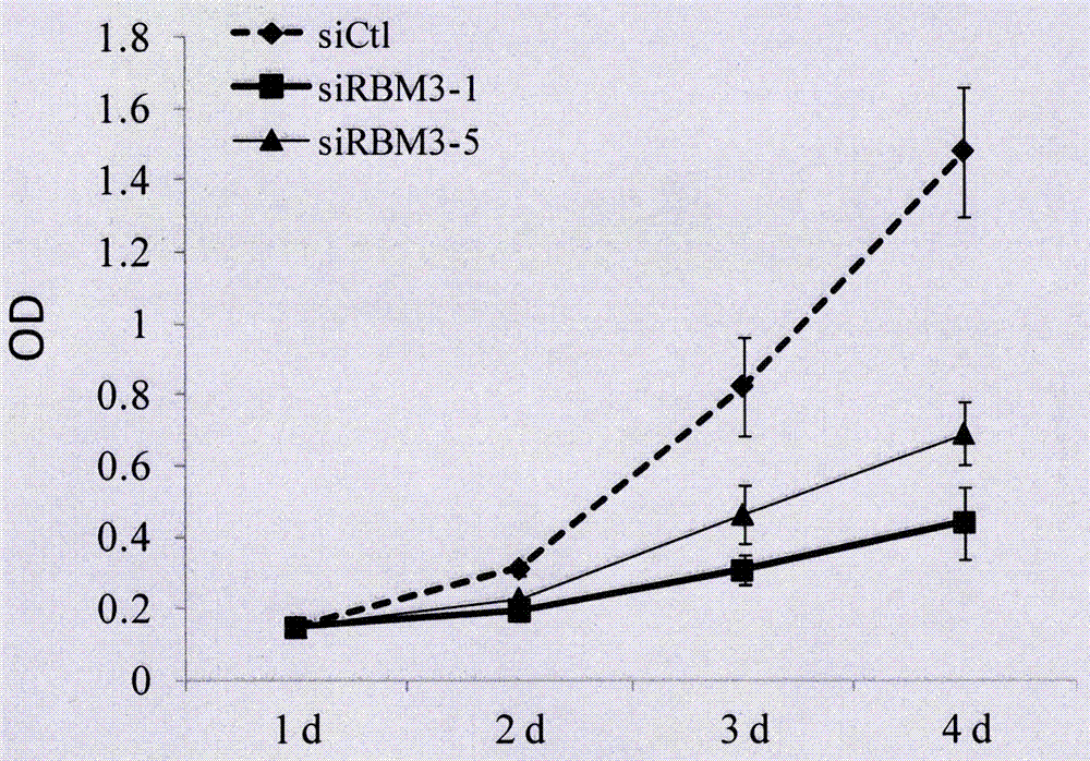 siRNA capable of inhibiting RBM3 gene expression of human melanoma and plasmid vector of siRNA