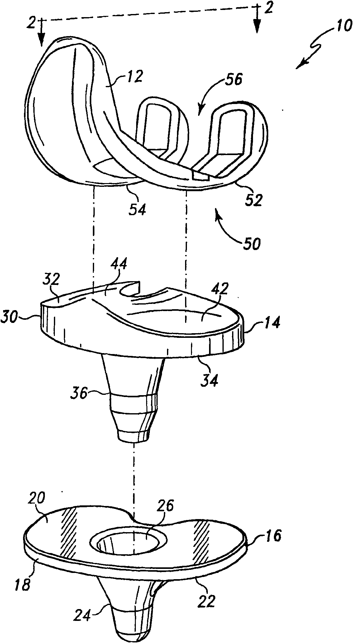 Posterior cructiate-retaining orthopaedic knee prosthesis having controlled condylar curvature