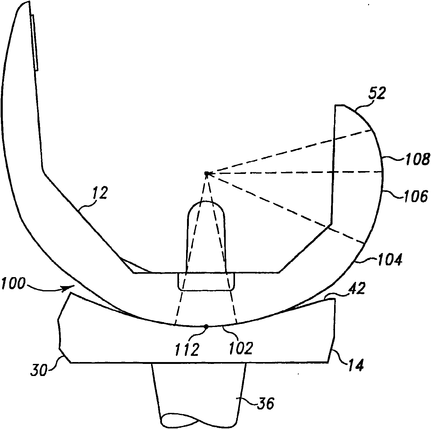 Posterior cructiate-retaining orthopaedic knee prosthesis having controlled condylar curvature