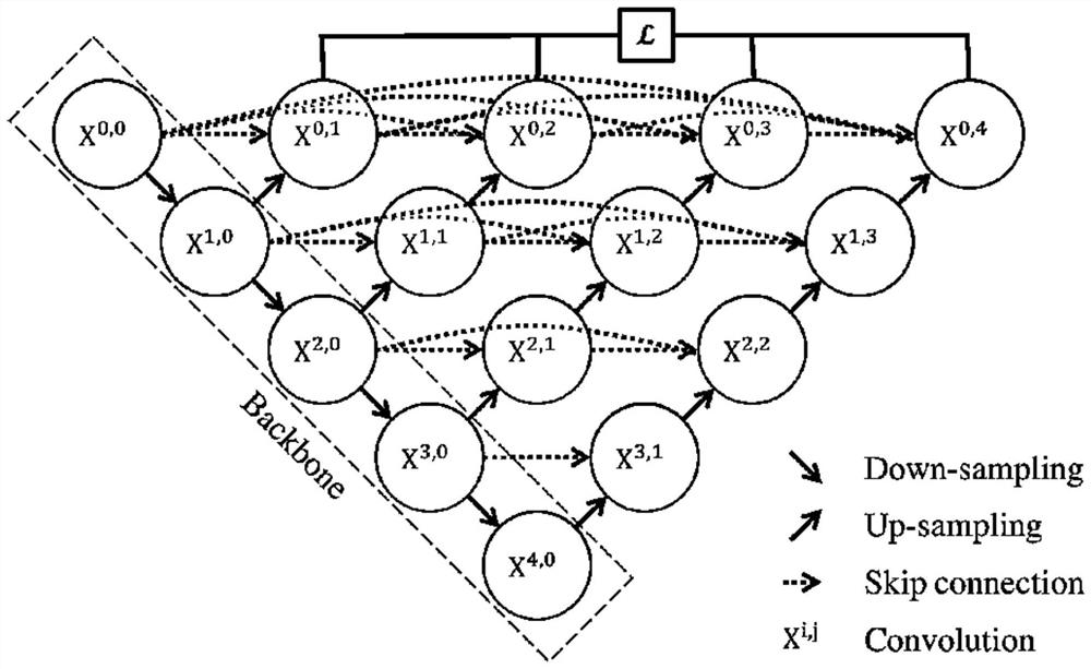 CT angiography image classification method suitable for Lee's artificial liver treatment