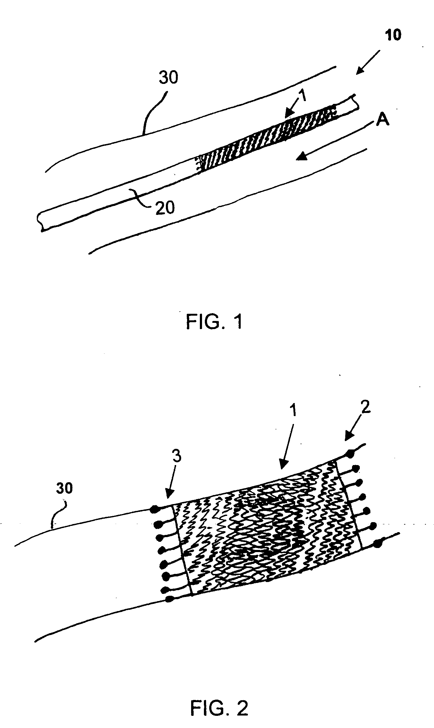 Stent and method for manufacturing the stent