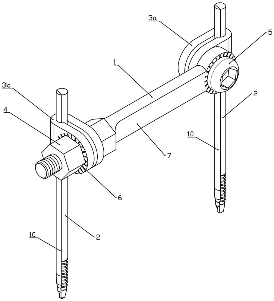 Single-rod double-nail external fixing frame