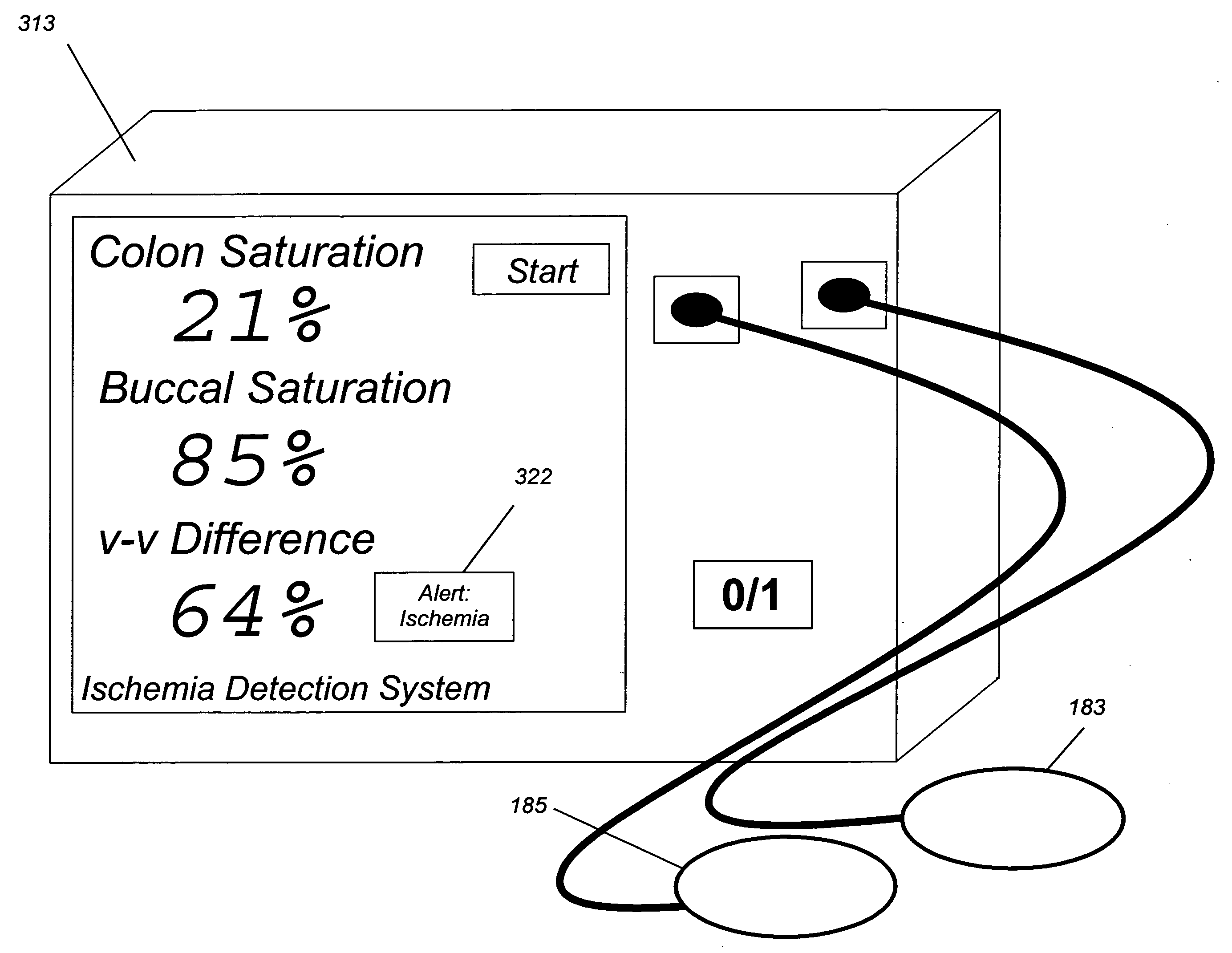 Difference-weighted somatic spectroscopy