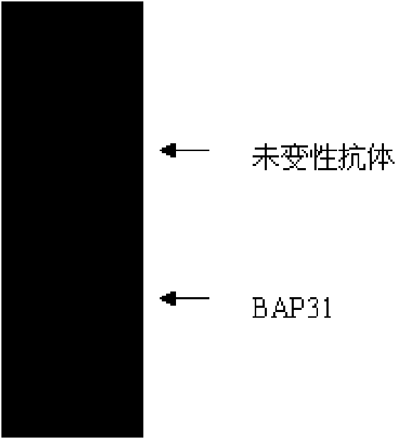 Monoclonal antibody of anti-human BAP31 protein, preparation method and application thereof