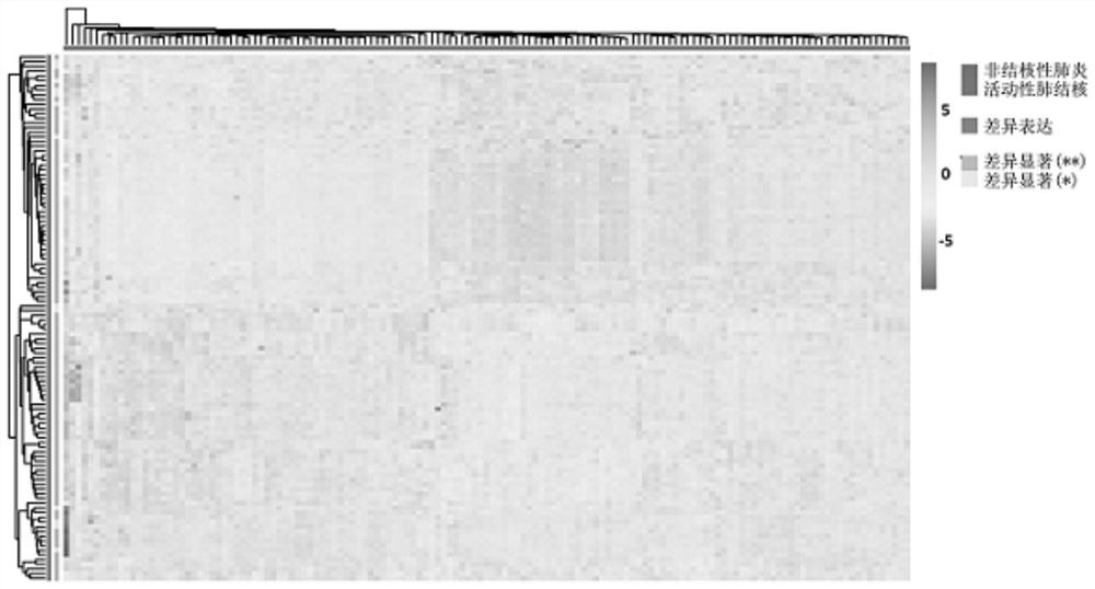 Plasma miRNA marker related to nontuberculous pneumonia and application thereof