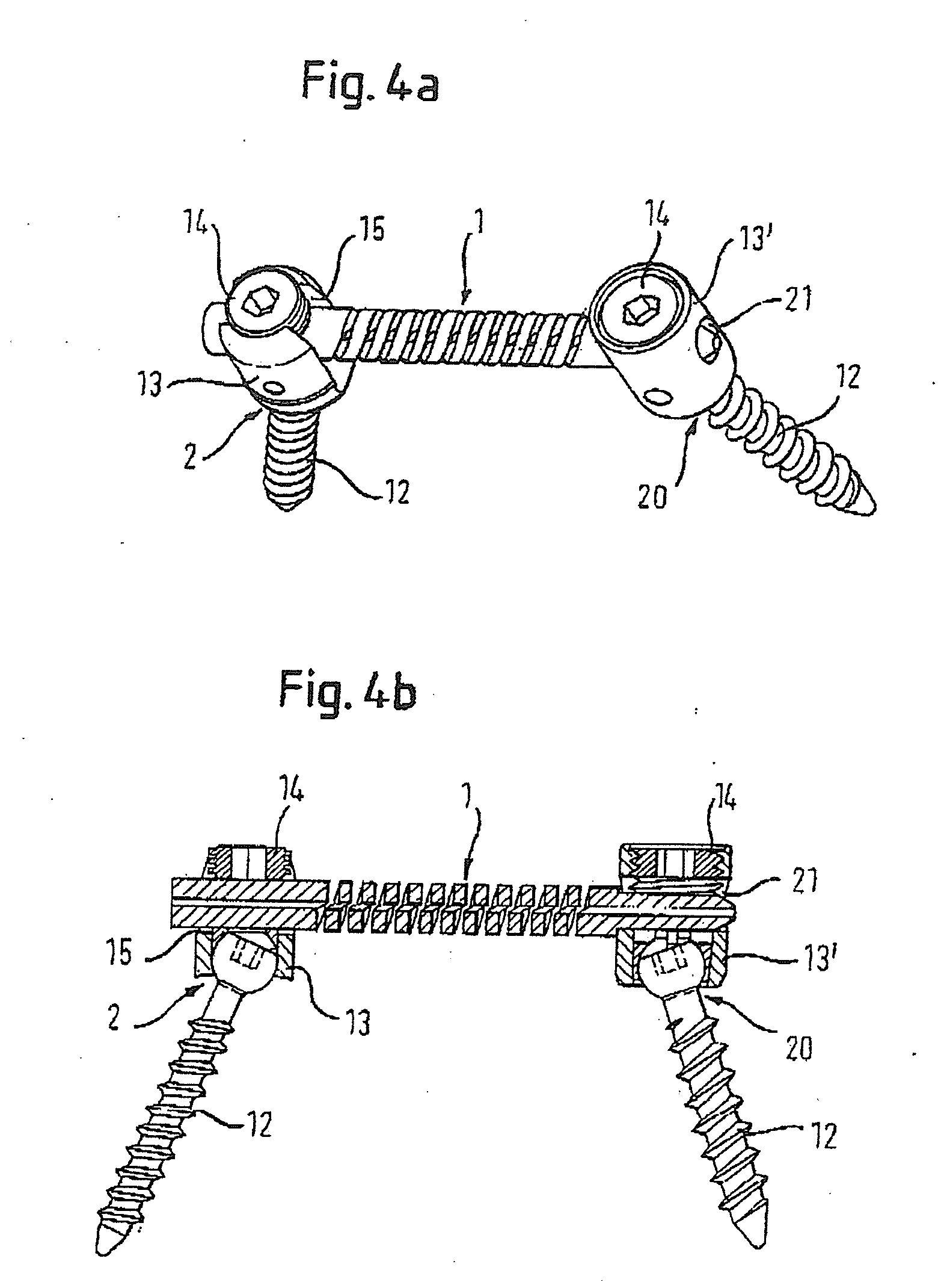 Rod-shaped implant element with flexible section