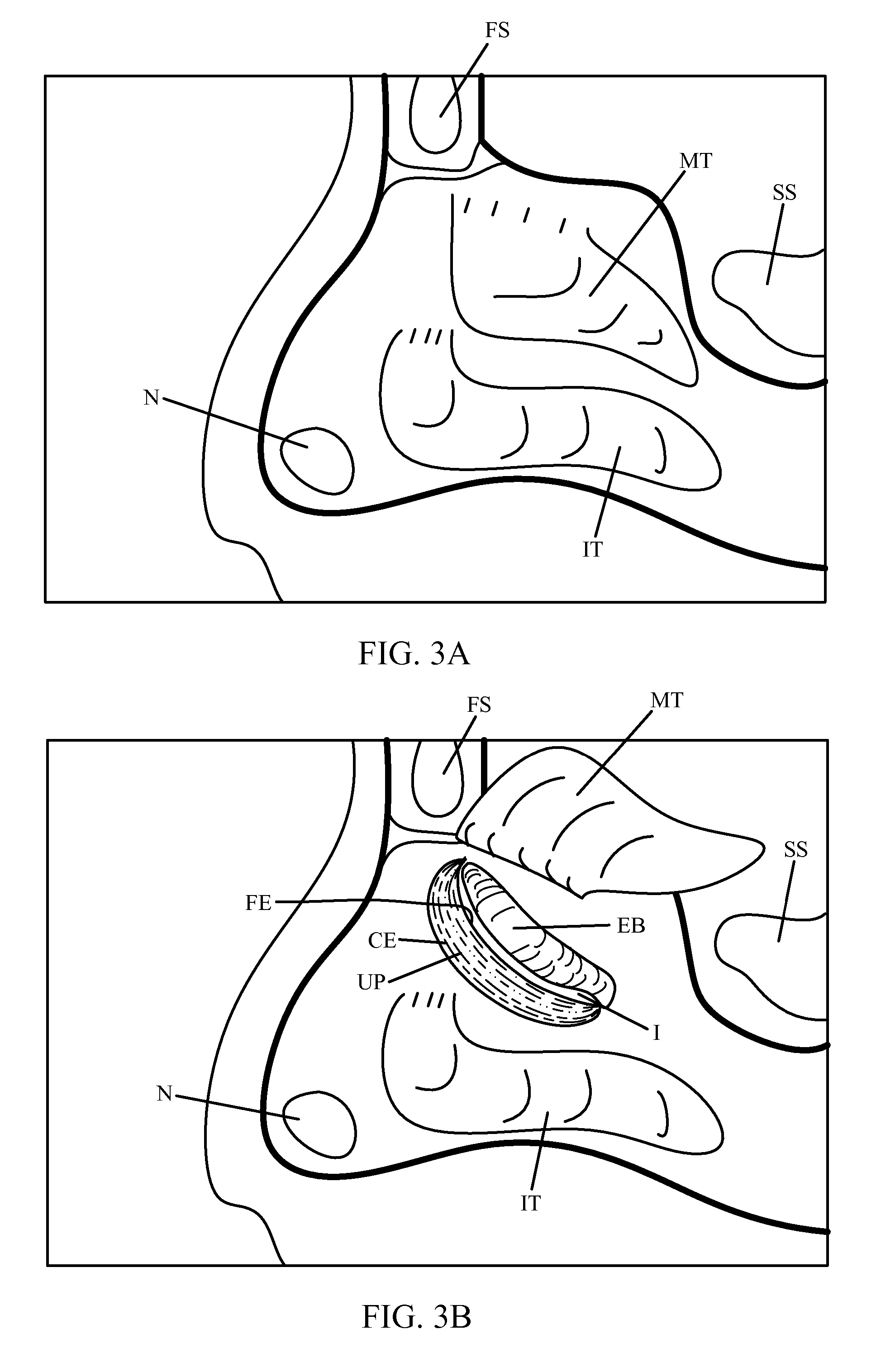 Guide catheter and method of use