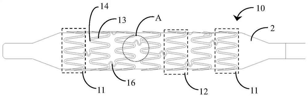 Infant pulmonary artery stent