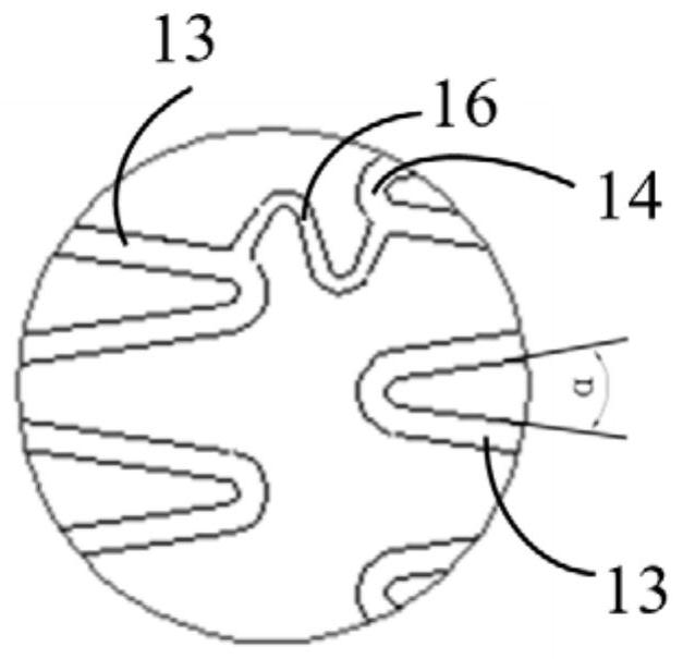 Infant pulmonary artery stent