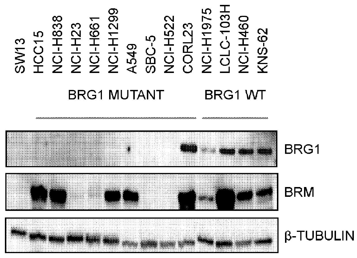 Biomarkers associated with brm inhibition