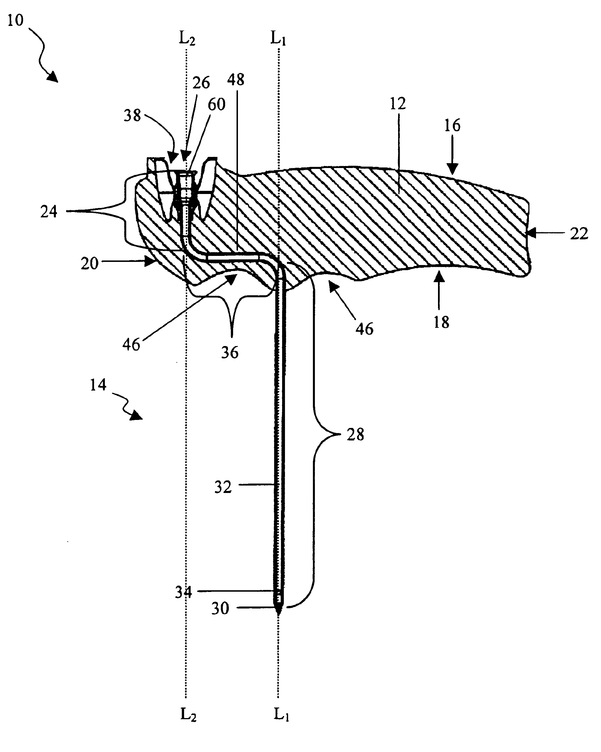 Bone marrow aspirator