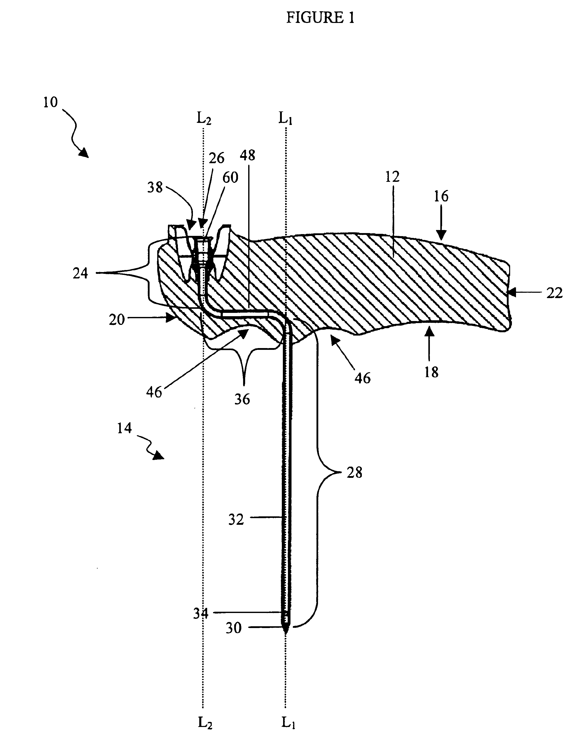 Bone marrow aspirator